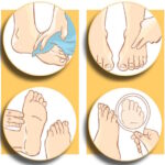 Diabetinės pėdos simptomai priežiūra rekomendacijos