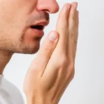 10 priežasčių kodėl gali varginti blogas kvapas iš burnos