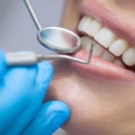 Kas yra odontologas Odontologas Kaune implantacija, protezavimas